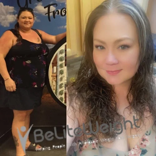 Weight loss before and after